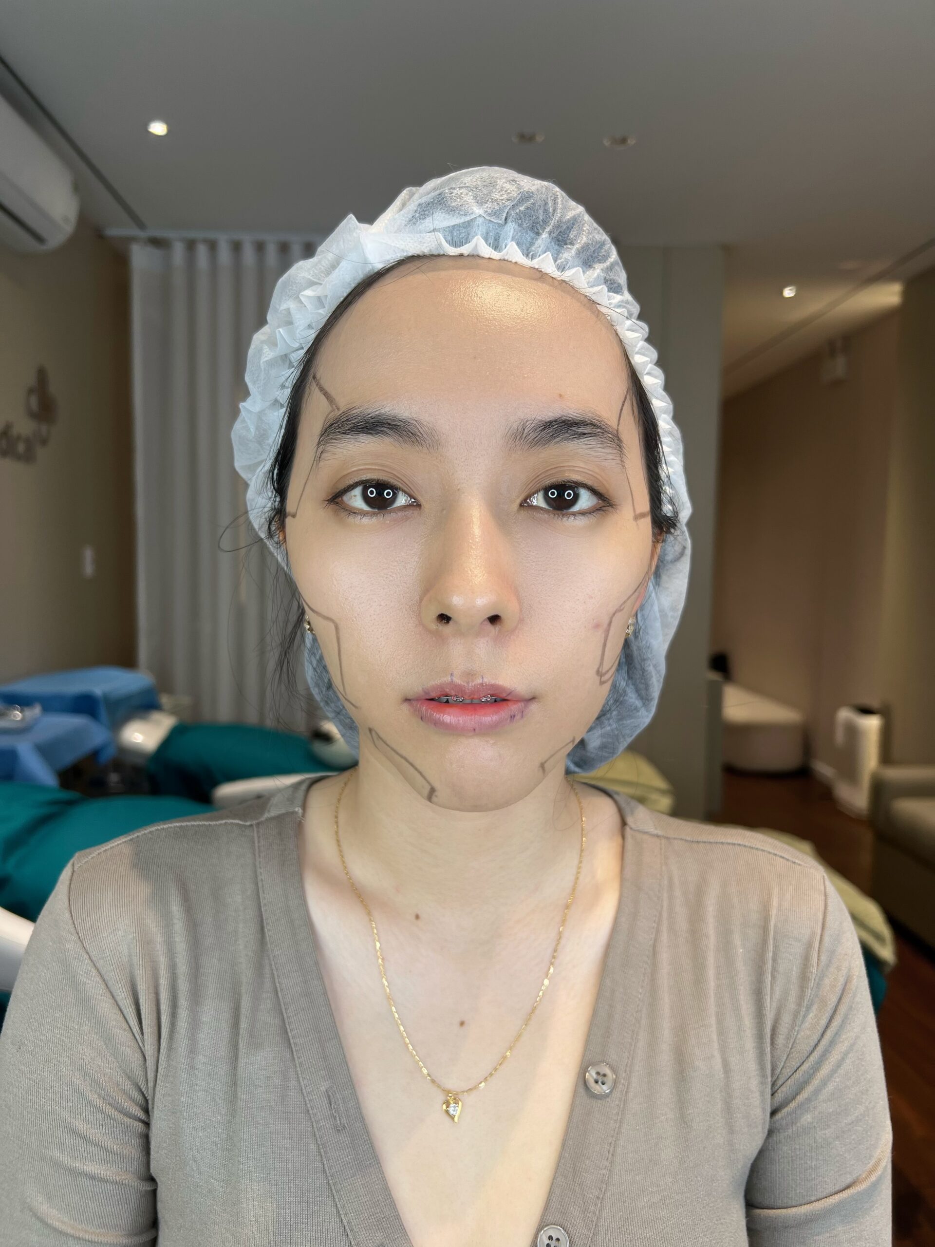 Thanh Thảo - Sau