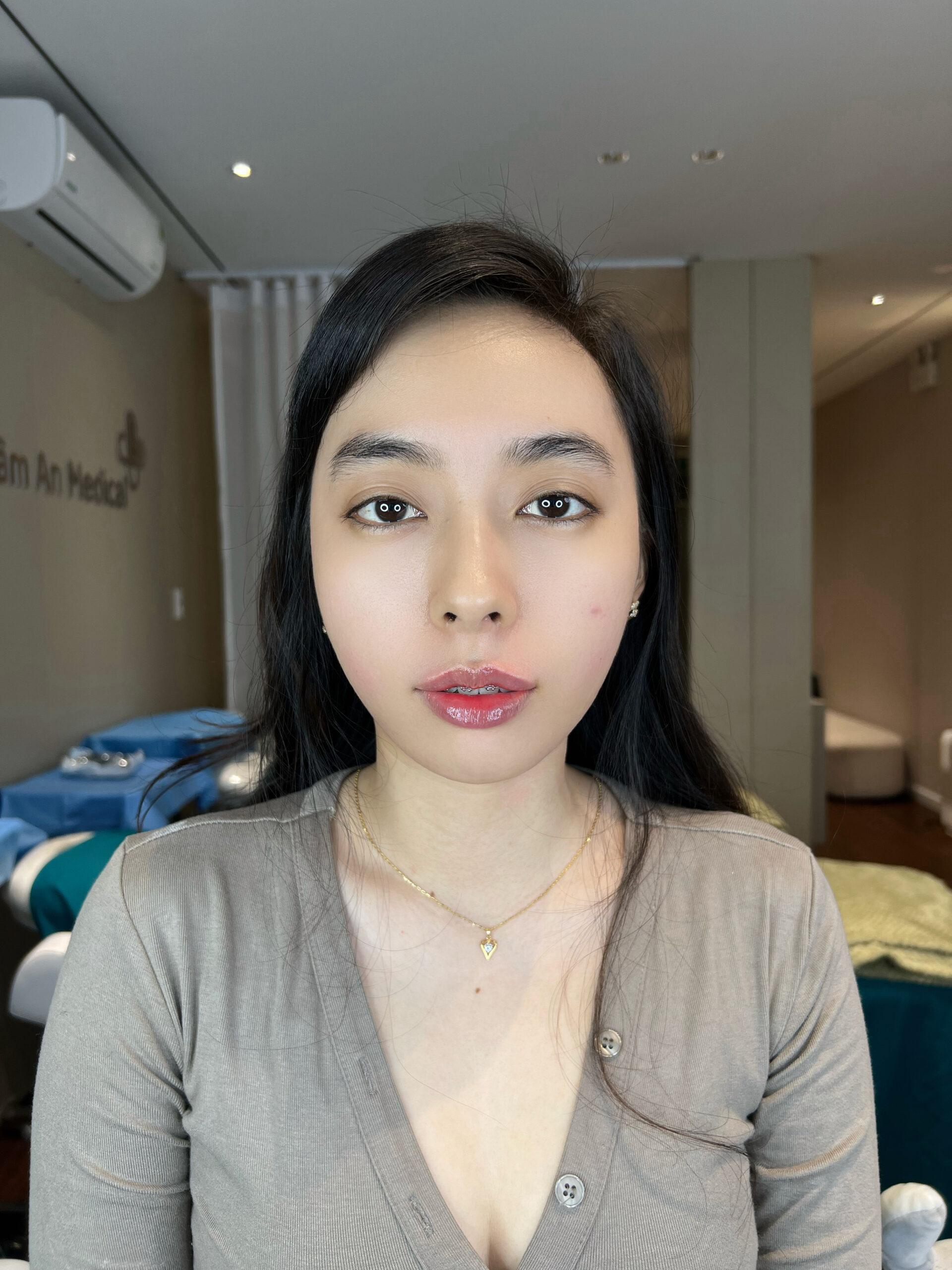 Thanh Thảo - Trước