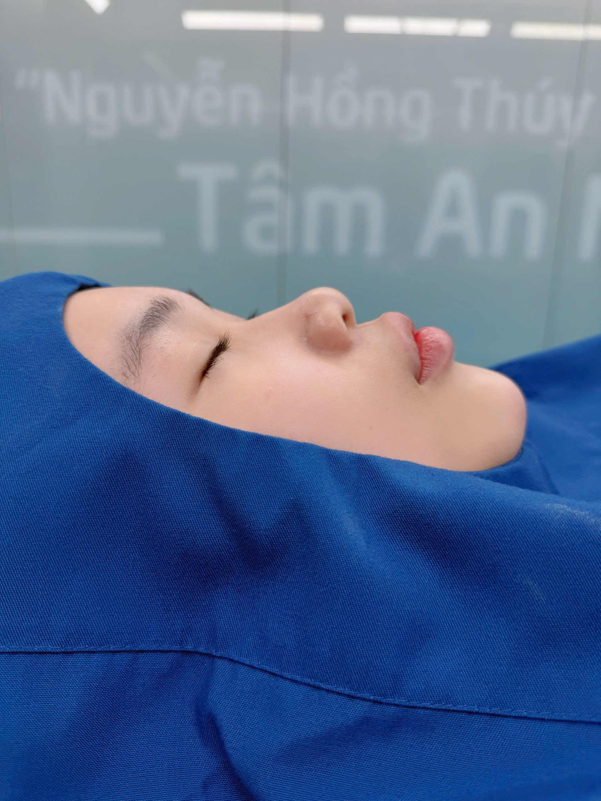 Minh Thúy - Sau
