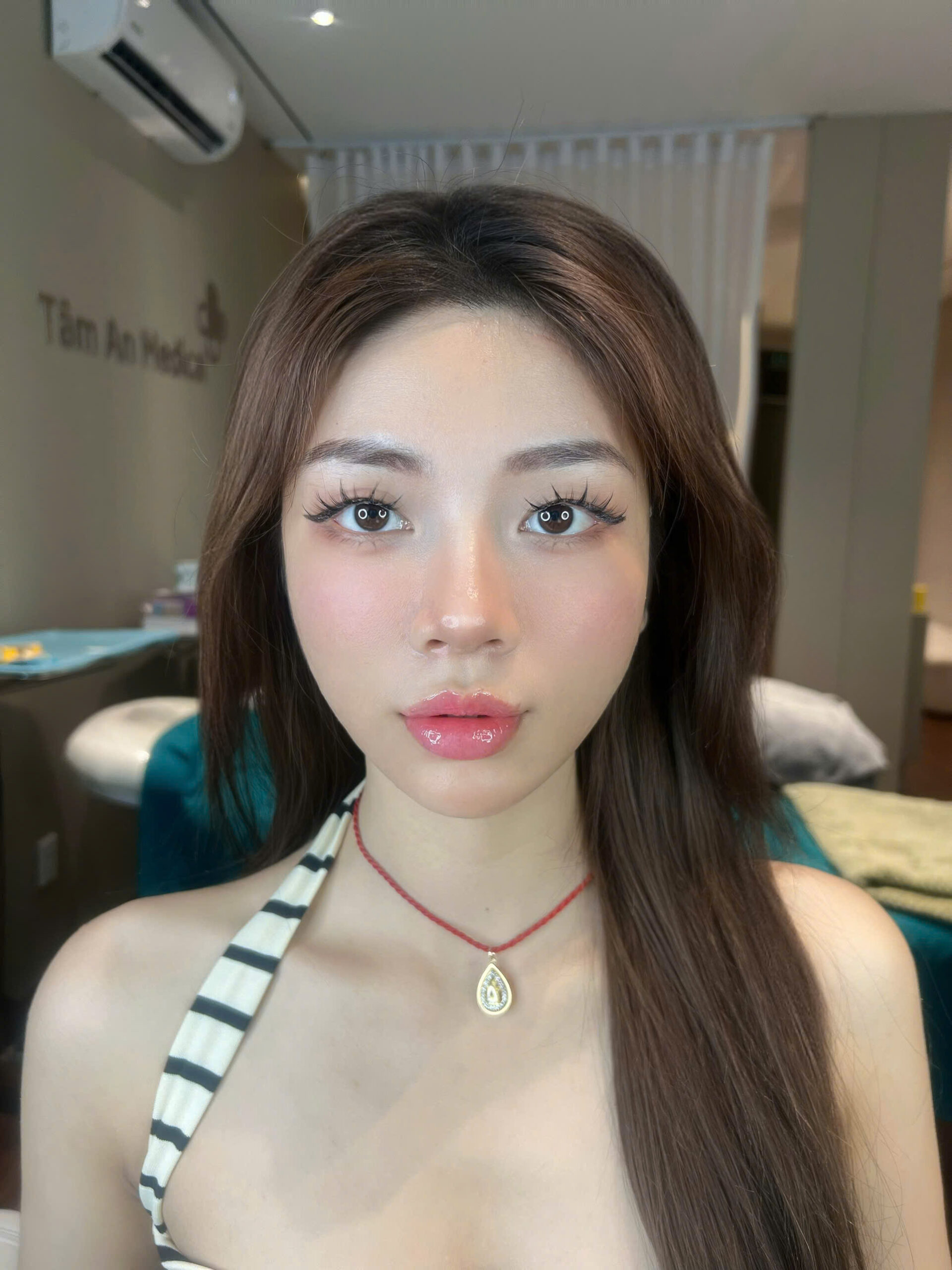 Bích Vân - Trước
